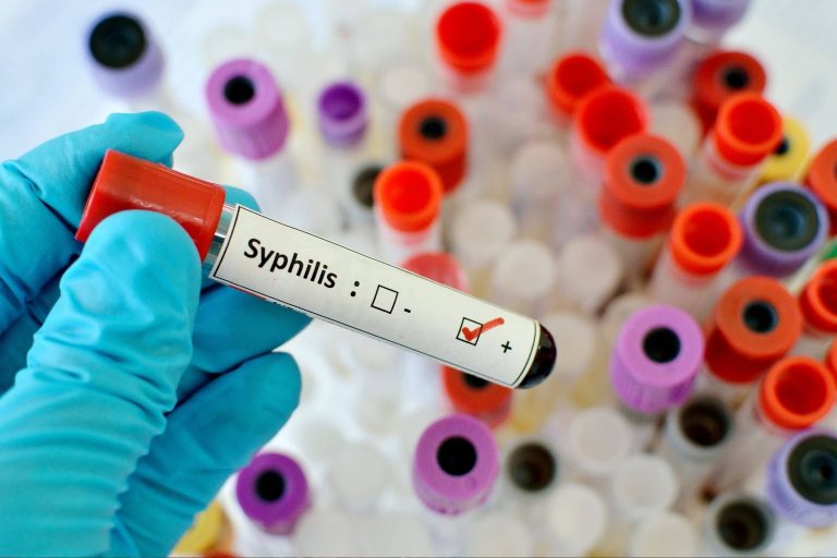 Syphilis | The Great Historical Defamer